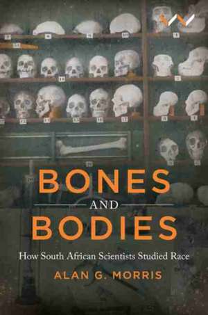 Bones and Bodies de Alan G Morris