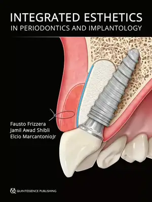 Integrated Esthetics in Periodontics and Implantology de Fausto Frizzera