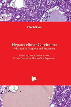 Hepatocellular Carcinoma de Costin Teodor Streba