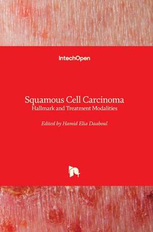 Squamous Cell Carcinoma de Hamid Daaboul