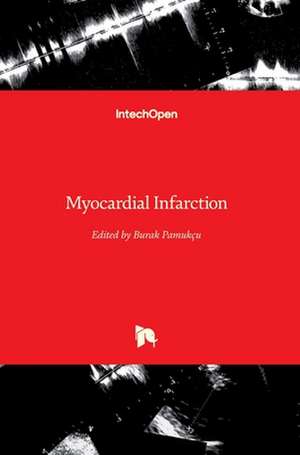 Myocardial Infarction de Burak Pamukçu