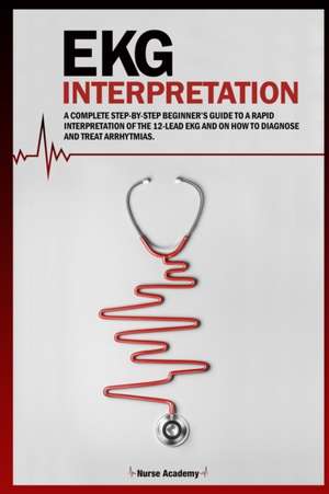 Ekg Interpretation de Nurse Academy