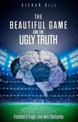 The Beautiful Game and the Ugly Truth de Kieran Gill