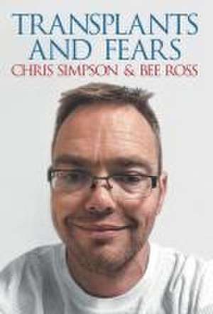 Transplants and Fears de Chris Simpson