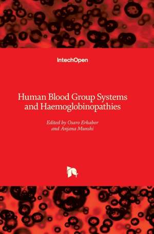 Human Blood Group Systems and Haemoglobinopathies de Osaro Erhabor