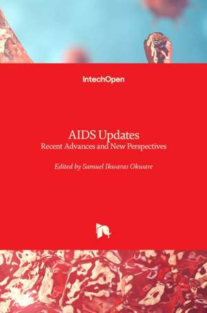 AIDS Updates de Samuel Okware