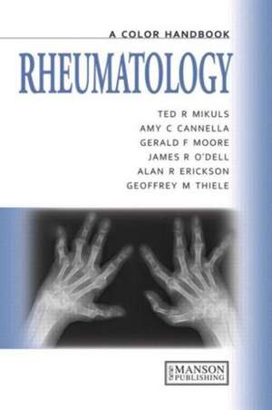 Rheumatology: A Color Handbook de Ted Mikuls