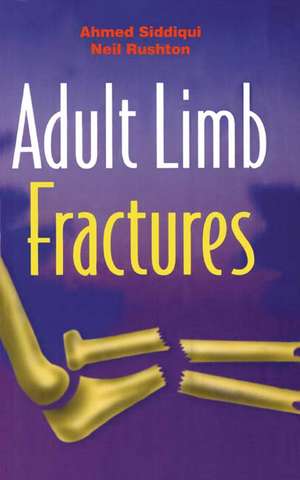 Adult Limb Fractures de Ahmed Mujtaba Siddiqui