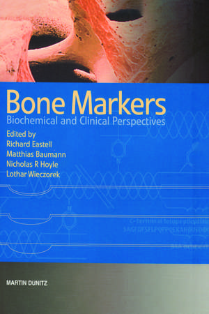 Bone Markers: Biochemical and Clinical Perspectives de Matthias Baumann