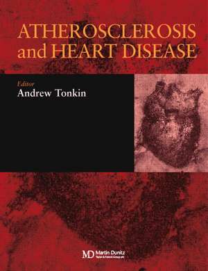 Atherosclerosis and Heart Disease de Andrew Tonkin