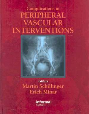 Complications in Peripheral Vascular Interventions de Martin Schillinger