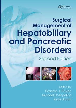 Surgical Management of Hepatobiliary and Pancreatic Disorders, Second Edition de Graeme J. Poston