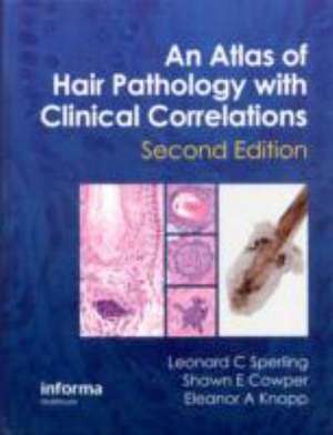 An Atlas of Hair Pathology with Clinical Correlations de Leonard C. Sperling