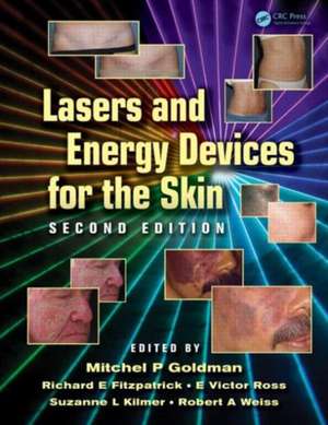 Lasers and Energy Devices for the Skin de Mitchel P. Goldman