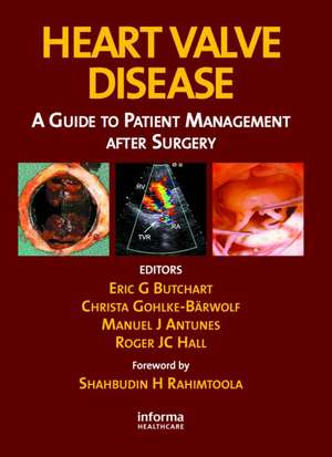 Heart Valve Disease: A Guide to Patient Management After Surgery de Eric G. Butchart