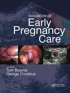 Handbook of Early Pregnancy Care de Thomas H. Bourne