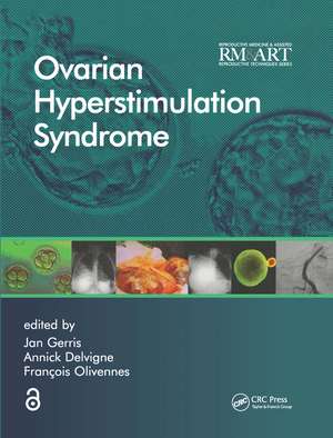 Ovarian Hyperstimulation Syndrome de Jan Gerris