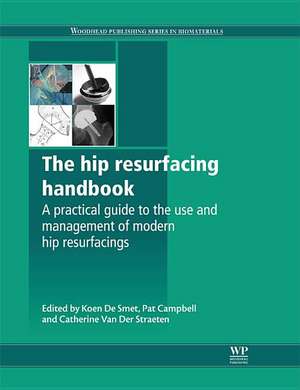 The Hip Resurfacing Handbook: A Practical Guide to the Use and Management of Modern Hip Resurfacings de K De Smet