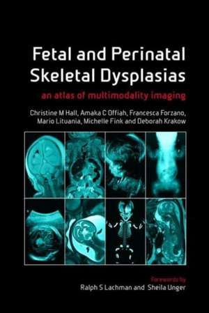 Fetal and Perinatal Skeletal Dysplasias: an Atlas of Multimodality Imaging de Christine M Hall