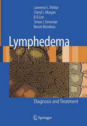 Lymphedema: Diagnosis and Treatment de Lawrence L Tretbar