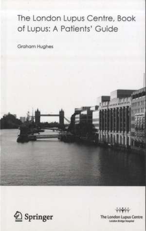 The London Lupus Centre, Book of Lupus: A Patients' Guide de Graham Hughes