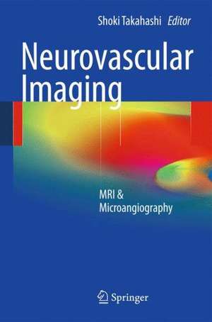 Neurovascular Imaging: MRI & Microangiography de Shoki Takahashi