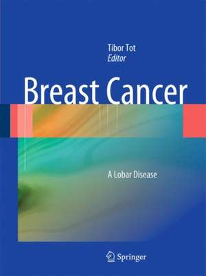 Breast Cancer: A Lobar Disease de Tibor Tot