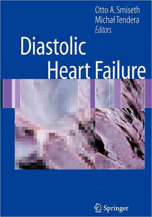 Diastolic Heart Failure de Otto A. Smiseth