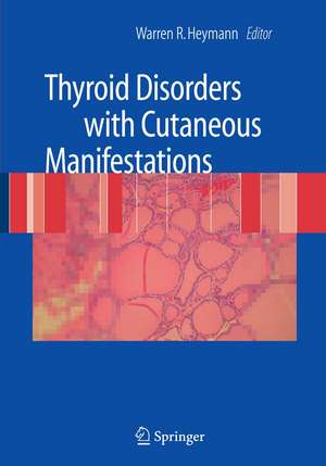 Thyroid Disorders with Cutaneous Manifestations de Warren R. Heymann