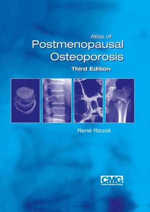 Atlas of Postmenopausal Osteoporosis: Third Edition de Rene Rizzoli