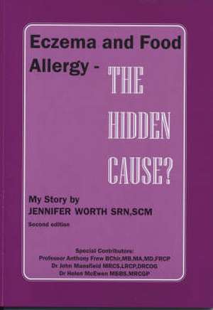 Eczema and Food Allergy - The Hidden Cause? de Jennifer Worth