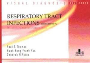 Visual Diagnosis Self-Tests in Respiratory Tract Infection de P. Thomas