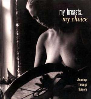 My Breasts, My Choice de Barbara Brown