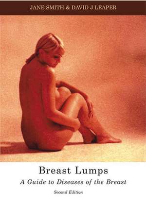 Breast Lumps de Jane Smith