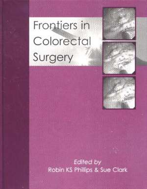 Frontiers in Colorectal Surgery de Robin Ks Phillips