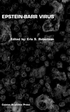 Epstein-Barr Virus de Erle S. Robertson