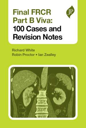 Final FRCR Part B Viva: 100 Cases and Revision Notes de Richard White