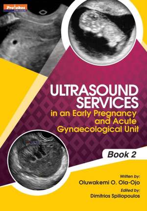 Ultrasound Services in An Early Pregnancy and Acute Gynaecological Unit. Book 2 de Oluwakemi Ola-Ojo