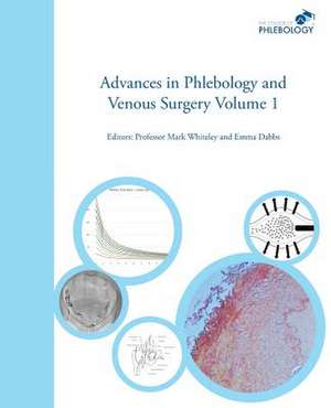 Advances in Phlebology and Venous Surgery Volume 1 de Mark Whiteley