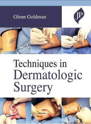 Techniques in Dermatologic Surgery de Glenn Goldman