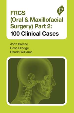 FRCS (Oral & Maxillofacial Surgery) Part 2: 100 Clinical Cases de John Breeze