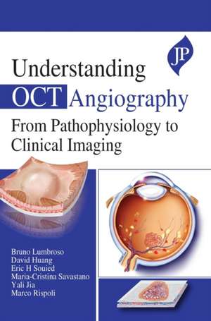 Understanding OCT Angiography: From Pathophysiology to Clinical Imaging de Bruno Lumbroso