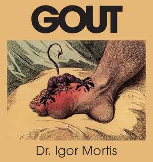 Gout de Igor Mortis