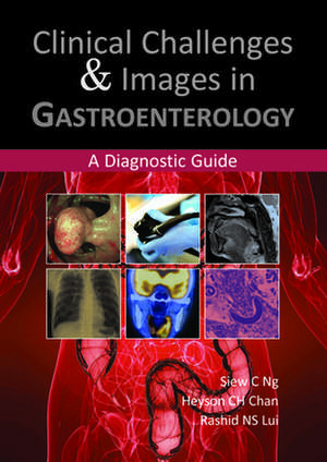 Clinical Challenges & Images in Gastroenterology: A Diagnostic Guide de Dr Siew C Ng MBBS, MRCP, PhD