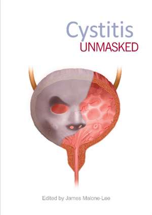 Cystitis Unmasked de James Malone-Lee