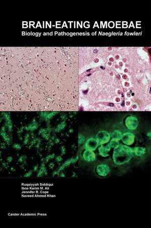 Brain-eating Amoebae de Ruqaiyyah Siddiqui