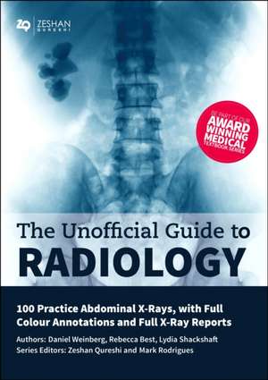 Unofficial Guide to Radiology: 100 Practice Abdominal X Rays with Full Colour Annotations and Full X Ray Reports de Daniel Weinberg