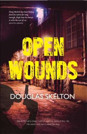 Open Wounds de Douglas Skelton