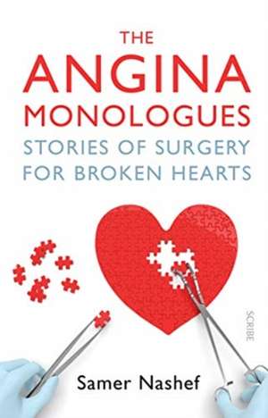 The Angina Monologues de Samer Nashef