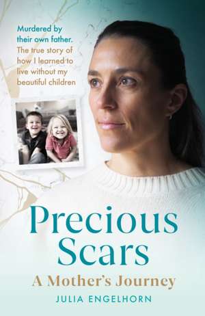 Precious Scars de Julia Engelhorn